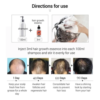 Eficient Cresterea Parului Ser Rapid Regenerarea Gros de Păr pentru a Preveni Pierderea Parului Deteriorat de Păr Reparații Naturale Produse de Îngrijire a Părului 30ML