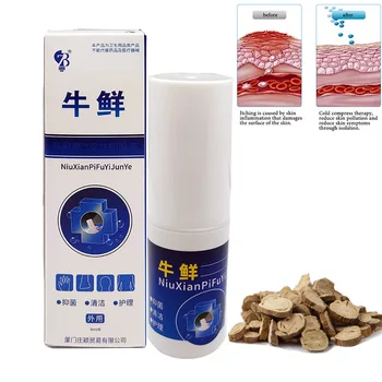 5pcs/mulțime de Relief Piele-Mail Spray Psoriasi Eczma spray Dermatita Mâncărime Reparații Corp Eczeme medicale Chineze