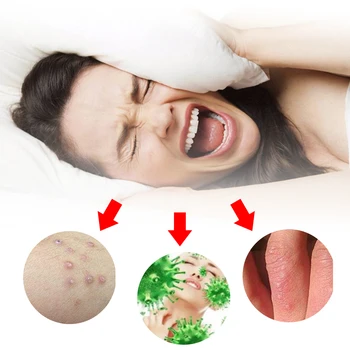 Anti-Crema Psoriazis Tratament Antibacterian Dermatită, Prurit Eczematoid Unguent pe bază de Plante de Îngrijire a Pielii Anti-itch Cream