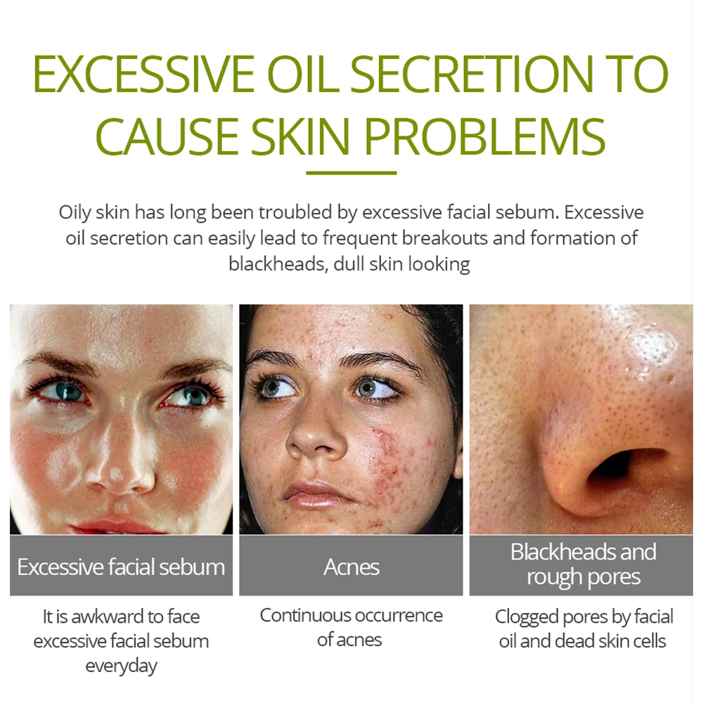 piele predispusă la acnee anti-îmbătrânire